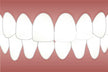 Dream Omen - Many Teeth Breaking and Falling Out?