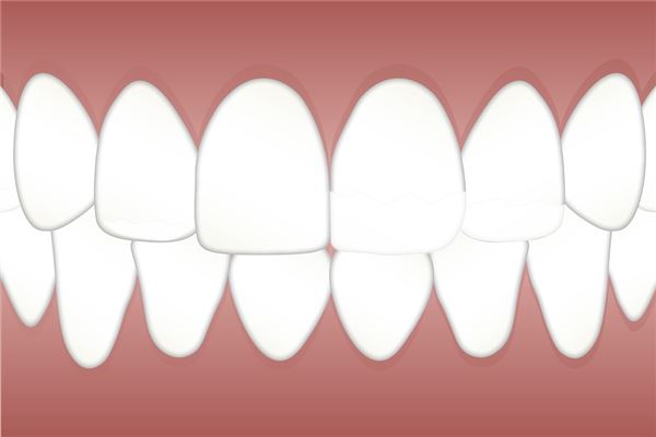Dream Omen - Many Teeth Breaking and Falling Out?