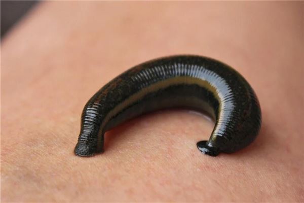 Leeches in woman's dream - financial omen?