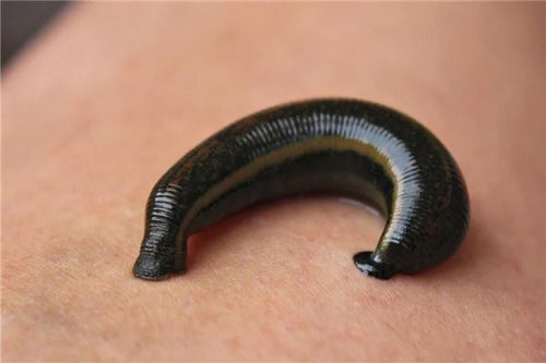 Leeches in woman's dream - financial omen?