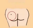 What is the relationship between moles and people's destiny