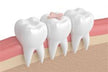 Woman Dreaming of a Lost Tooth Filled Again: Meaning: Five Elements Water (水), mixed omen. Auspicious in winter, inauspi