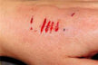 Woman Dreaming of Blood from Her Left Hand: Five Elements Water (水), mixed omen. Auspicious in winter, inauspicious in a