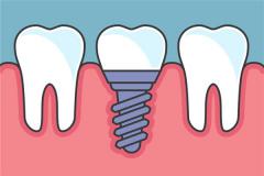 Woman Dreaming of Losing Half a Tooth: Meaning: Five Elements Water (水), mixed omen. Auspicious in winter, inauspicious 