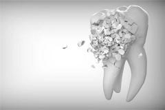 Woman Dreaming of Teeth Crumbling to Fragments: Five Elements Water (水), mixed omen. Auspicious in winter, inauspicious 